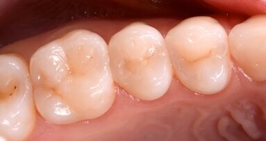 Los adhesivos univerales