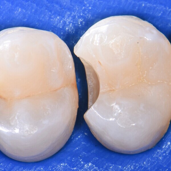 (image: Directa Dental)