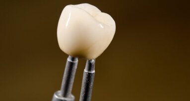 Проучване изследва износването на различни керамични възстановявания на млечното съзъбие