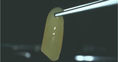 In Odontoiatria sono legali i fattori di crescita piastrinici autologhi?