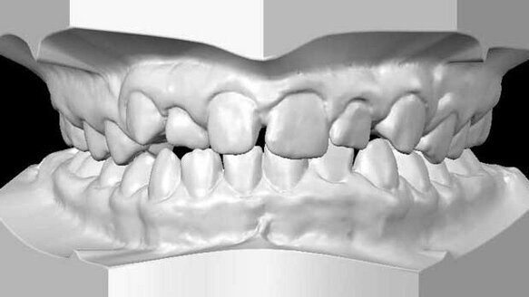 Align completes acquisition of Cadent