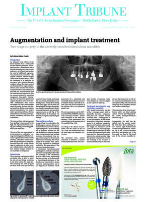 Implant Tribune Middle East & Africa No. 1, 2017