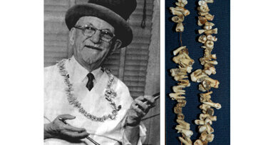 El gran “Painless Parker”, dentista y artista de circo