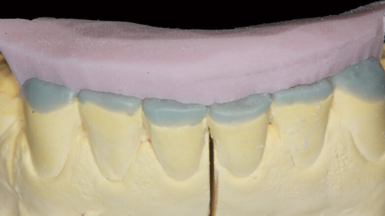 Minimální invazivita – maximální efektivita: Paradigma současné dekády záchovné stomatologie