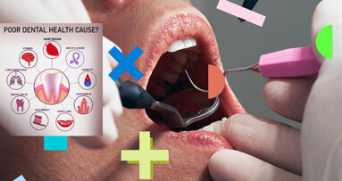 Oral ailments may affect cognitive health, warn experts