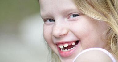 Zahnverlust ist immer behandlungsbedürftig