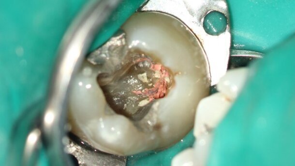 White lines or white lies?