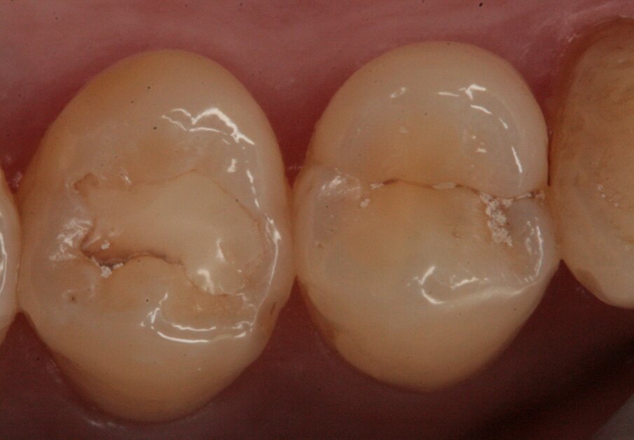 Fig. 13_Restauro presente sul 25.