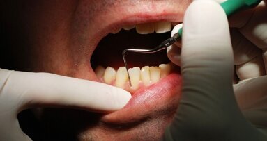 Nie każdy stan zapalny to paradontoza