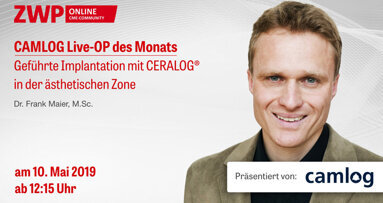 CAMLOG Live-OP im Rahmen der ISMI-Jahrestagung am 10. Mai