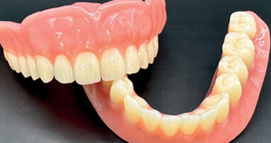 3D-printed 28-tooth complete dentures: A modern approach to dental solutions