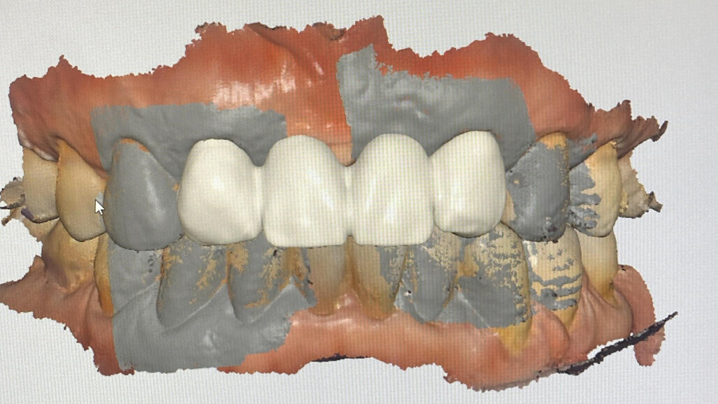 Digitalisation for the conventional and analogue dentist: Ten key points