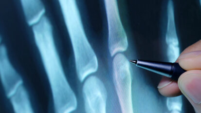 Healthy teeth lower rheumatoid arthritis pain