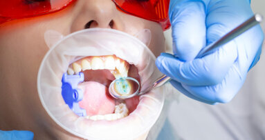 Dental caries prevalence continues to affect Australian adults, study says