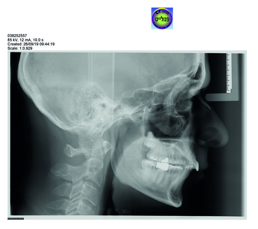 Fig. 7_Radio panoramique