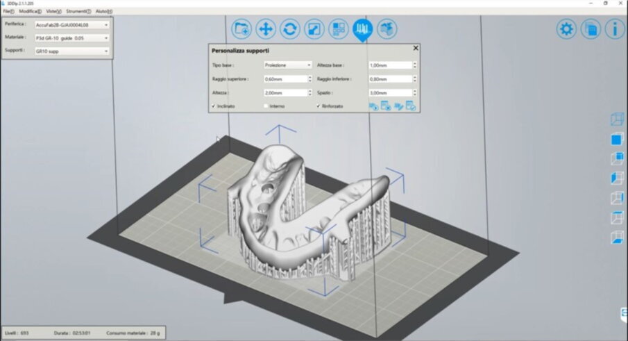 Figg. 33, 36_3DDLP software.