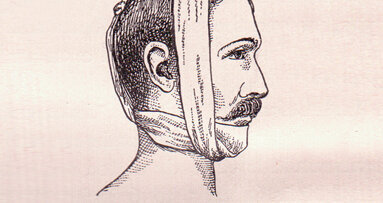 Meer bewijs nodig voor afbreekbare materialen in de kaakchirurgie