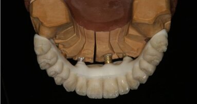 Korony teleskopowe nowej ery – część 2