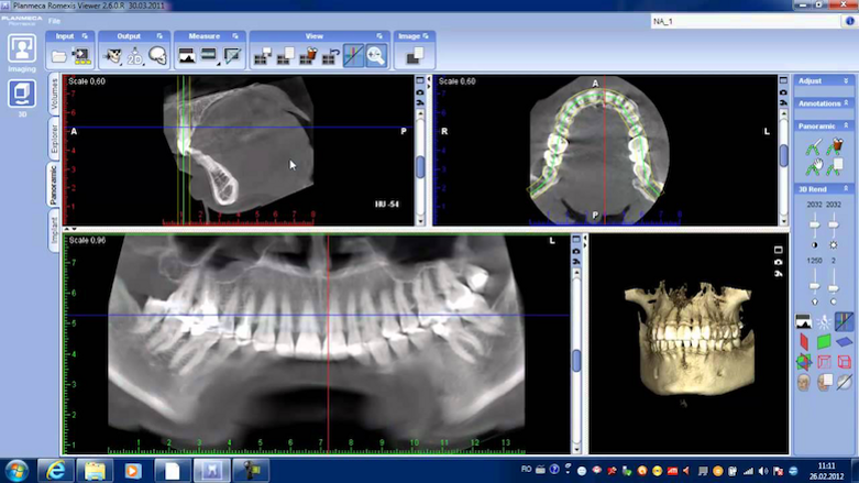 Para el mejor diagnóstico, utilice el mejor software