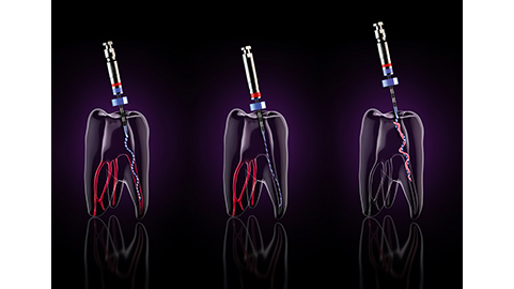 FKG Dentaire – XP-endo Solutions