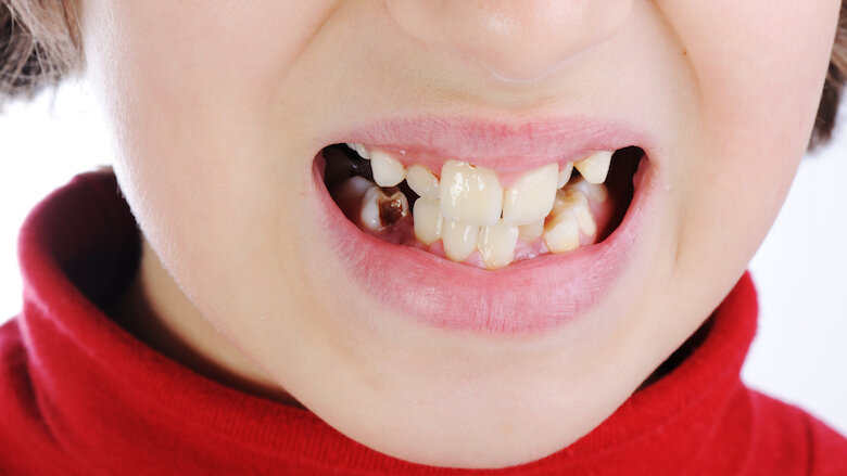 Oral health emphasised in Northern Ireland health funding report