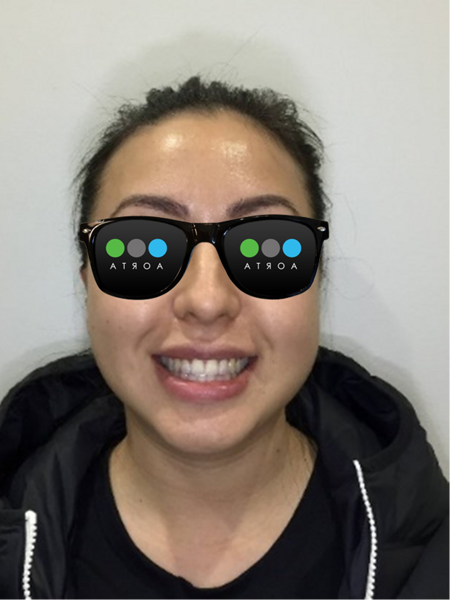 Fig. 29: Patient’s facial photograph after aligner treatment.