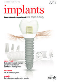 implants international No. 3, 2021 implants international No. 3, 2021