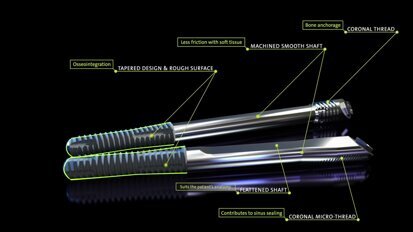 Straumann Zygomatic Implant System