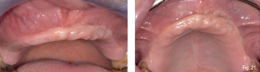 Fig. 21