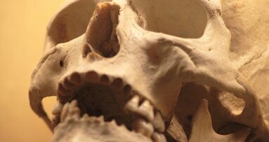 Drukowane implanty z PW pomagają w odbudowie kości