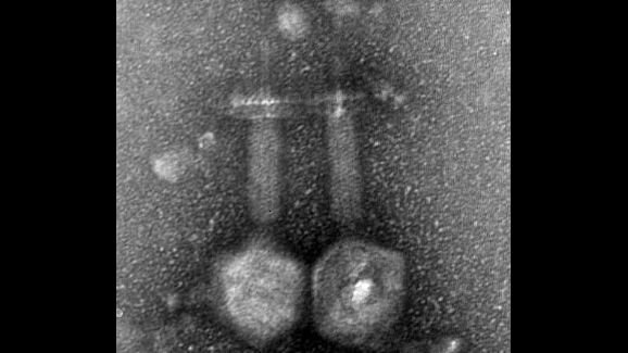 וירוס חיידקים הנמצא בשפכים של ירושלים יכול למנוע זיהומי תעלות שורש