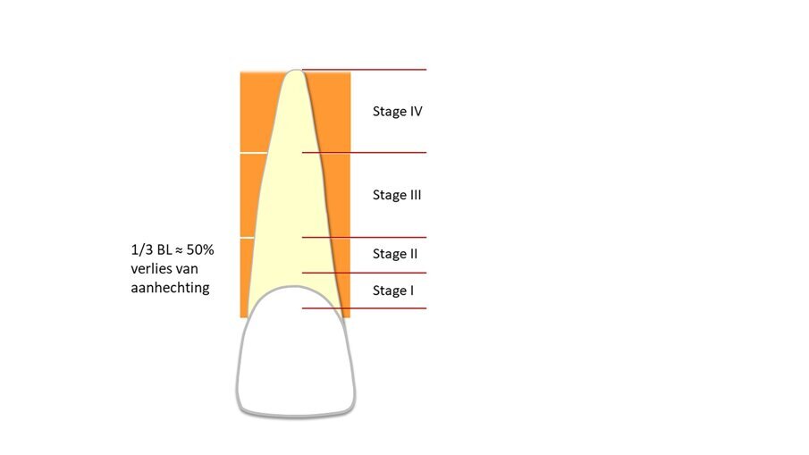 Figuur 2. Visualisatie van criteria van botafbraak op de röntgenfoto – Staging.