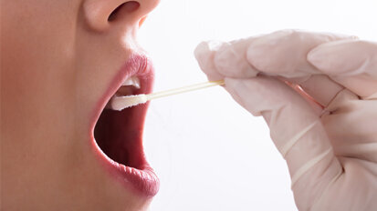 Früherkennung von Mundkrebs: Biomarker im Speichel Früherkennung von Mundkrebs: Biomarker im Speichel