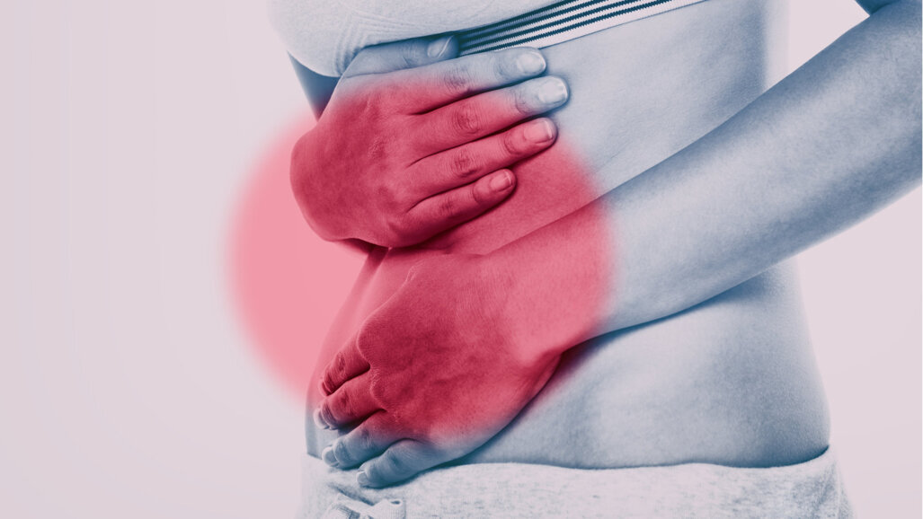 Parodontitis und Karies: häufiger bei chronischen Darmentzündungen