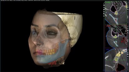 Applicazioni dell’intelligenza artificiale in Ortodonzia