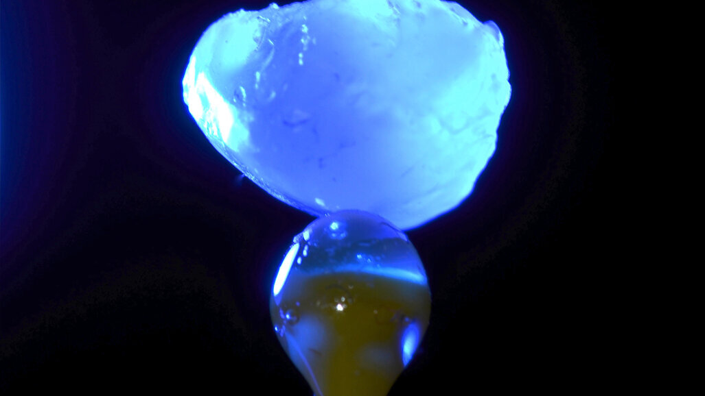 Dientes supernumerarios