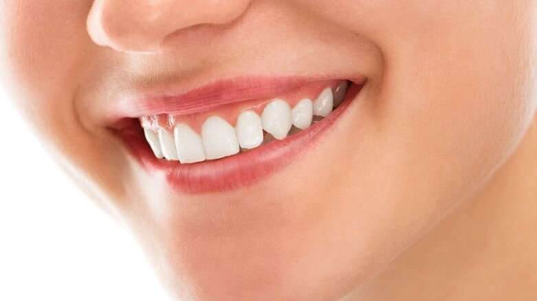 Wereld Mondgezondheidsdag: iets van gemerkt?