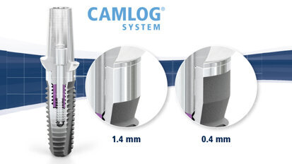 Interview: “Are your workflows perio-friendly and efficient?”