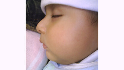 Apuntes sobre desarrollo de la dentición primaria Apuntes sobre desarrollo de la dentición primaria