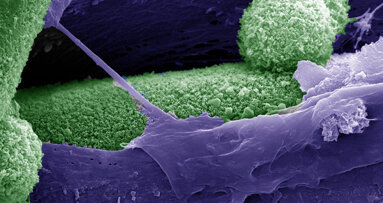 Hauptschalter für die Regeneration von Knochengewebe aufgedeckt