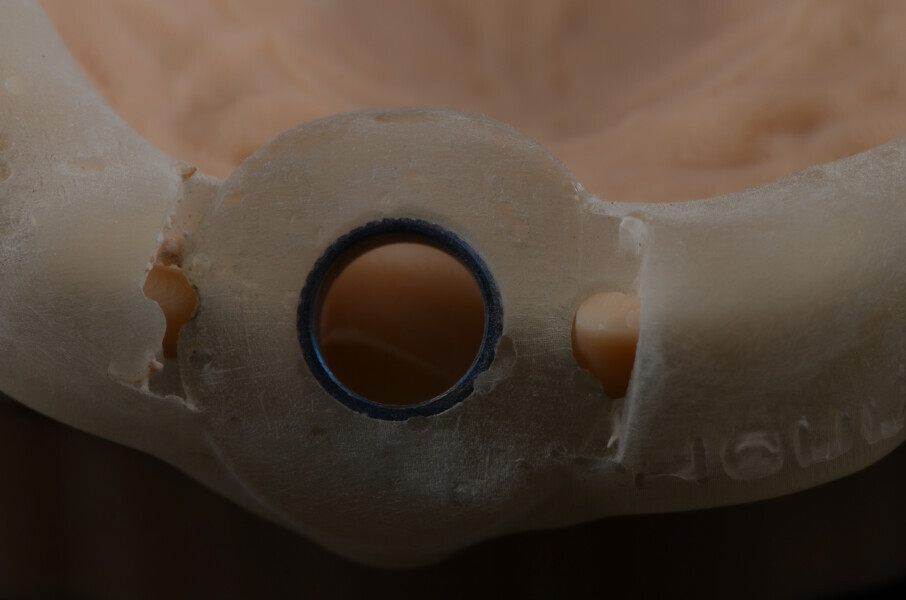 Fig. 11b: Try-in of the surgical guide on the resin model, occlusal view.