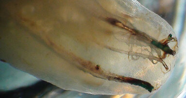 Interview: 'The immense variability of human tooth anatomy'