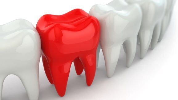 Why dentistry needs branding