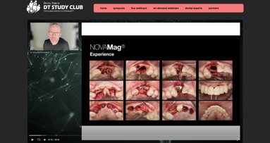 Hơn 4.600 người tham gia hội nghị chuyên đề trực tuyến về cấy ghép nha khoa