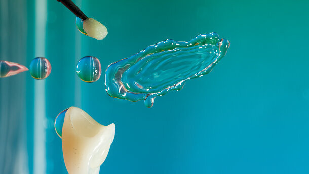 La cementación predecible de restauraciones estéticas indirectas