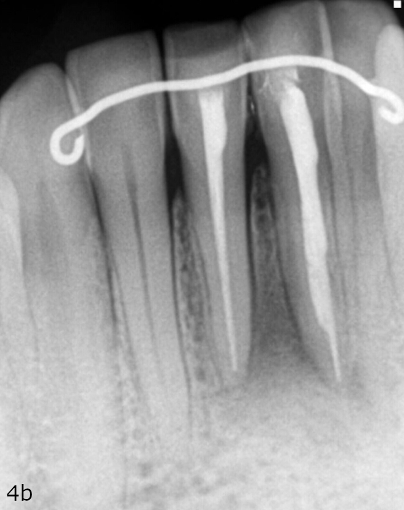 Fig. 4b: ... and the situation at the nine-month follow-up.