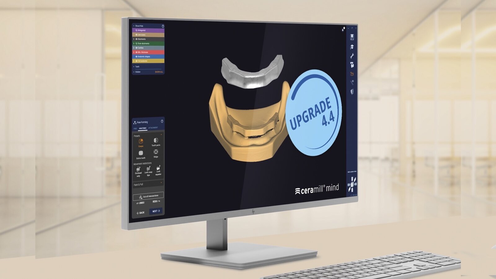 Ceramill 4.4: más eficiente y más indicaciones 