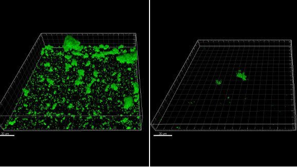 Aminoácido natural comum pode tornar-se novo meio de controlar biofilme dental