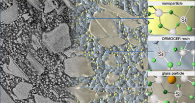 Webinar: Expert presents first purely ceramic-based restorative material
