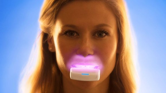 Un dispositivo que disminuye el tiempo de tratamiento ortodóntico